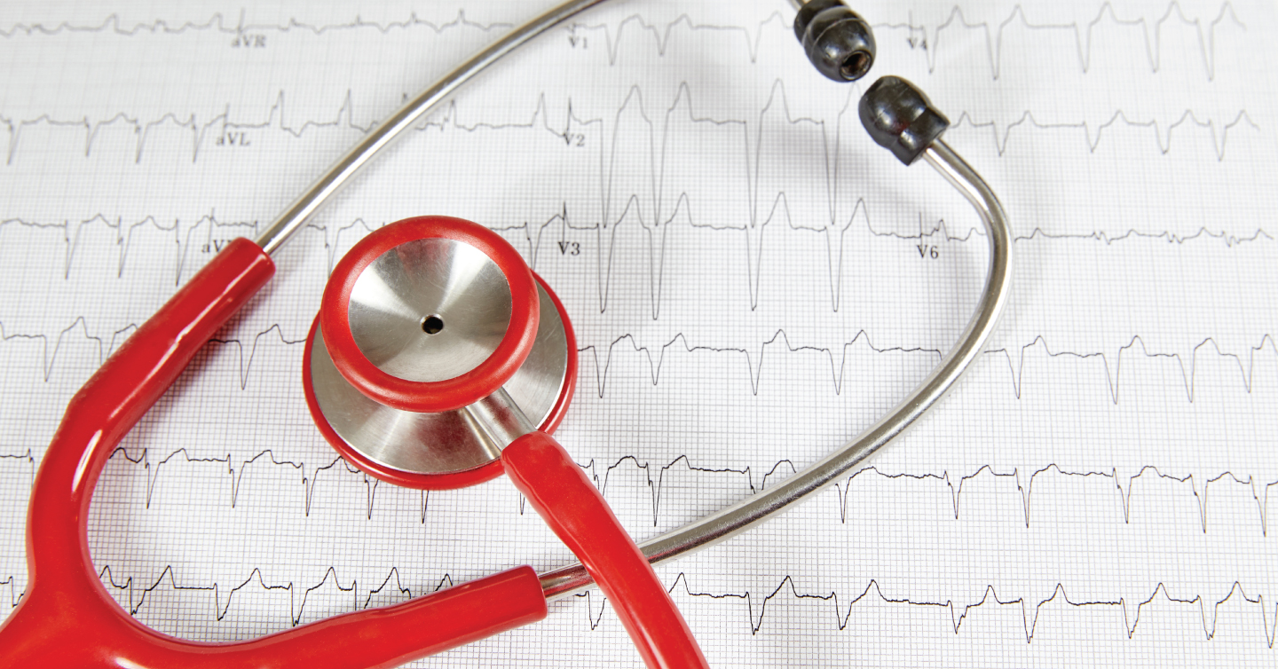 stethoscope over heartbeat chart